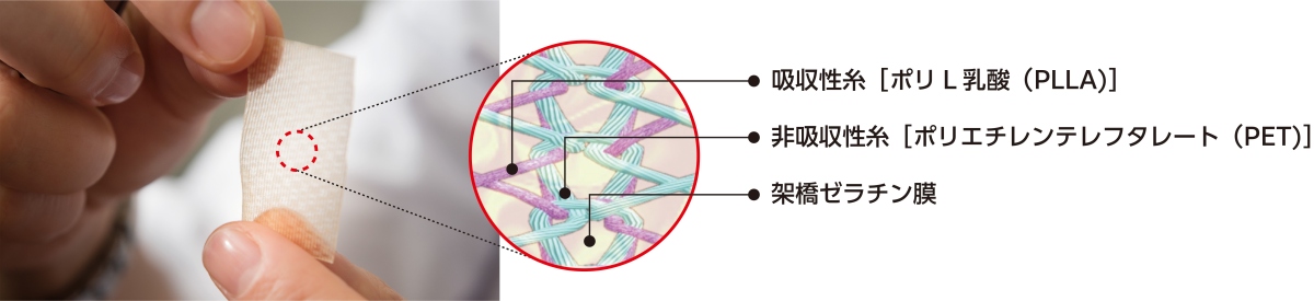 シンフォリウムは吸収性糸と非吸収性糸で編まれた経編構造に架橋ゼラチン膜でコーティングしています