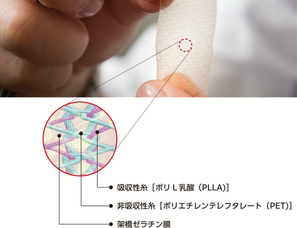 シンフォリウムは吸収性糸と非吸収性糸で編まれた経編構造に架橋ゼラチン膜でコーティングしています