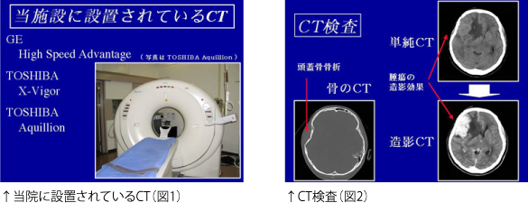 ↑当院に設置されているCT（図1）↑CT検査（図2）