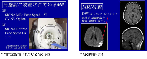 ↑当院に設置されているMR（図3）↑MRI検査（図4）