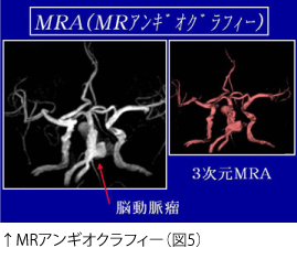 ↑MRアンギオクラフィー（図5）