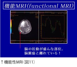 ↑機能性MRI（図11）