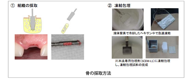 骨の採取方法