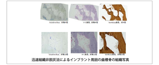 迅速組織非脱灰法によるインプラント周囲の歯槽骨の組織写真