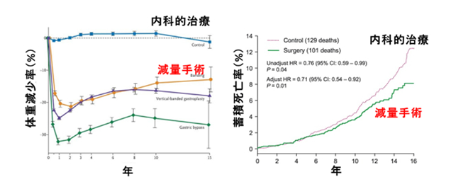 肥満外科治療に関するエビデンス