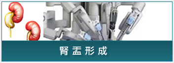 ロボット手術（膀胱全摘除）